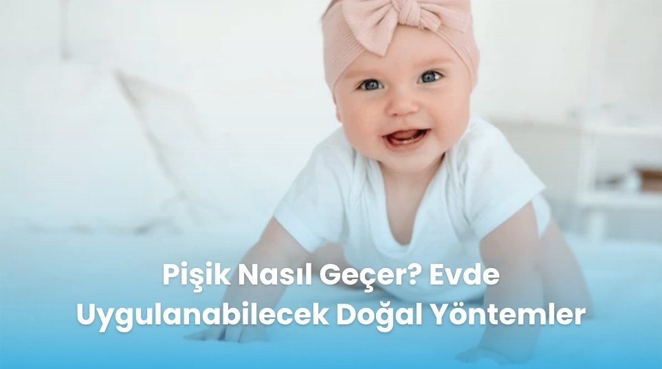 Pişik Nasıl Geçer? Evde Uygulanabilecek Doğal Yöntemler
