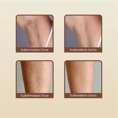 Mieco Sapphire Mor IPL Epilasyon Cihazı Safir Buz Kompresli