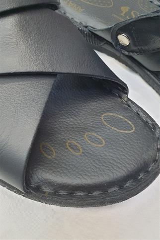 Siyah Ortopedik Sandalet