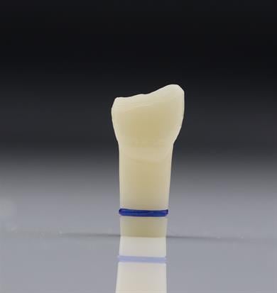 1.1 CLASS IV FRACTUREÇene ve Diş ModelleriP-OCLUSALMS DENTAL