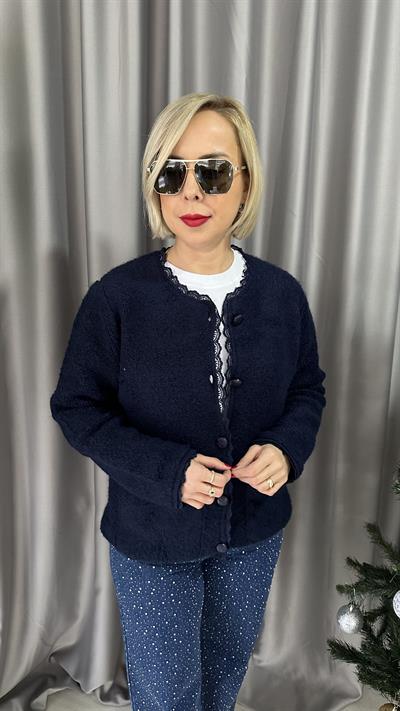 DANTEL DETAYLI DERİ DÜĞMELİ ÖNDEN CEPLİ LACİVERT HIRKA