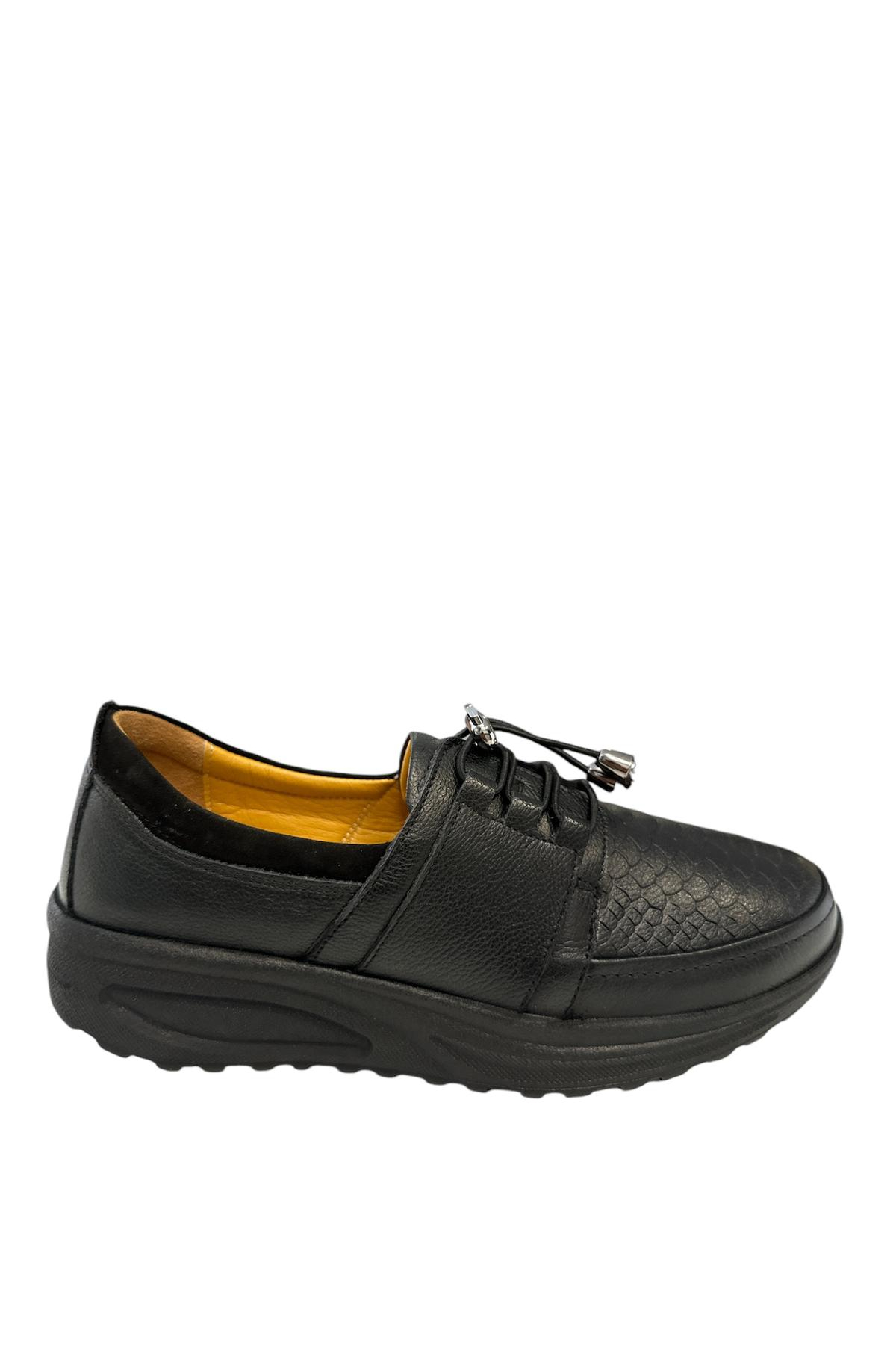 Castle Black YLDZ-42640 Kadın Hakiki Deri Ortopedik Comfort Ayakkabı Siyah