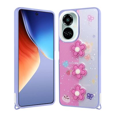 Tecno Camon 19 Pro Uyumlu Kılıf Parlayan Simli Kabartma Figürlü Zore Cevze Kapak