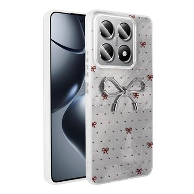 Xiaomi 14T Pro Uyumlu Kılıf Kamera Korumalı Figürlü Zore Ponti Silikon Kapak