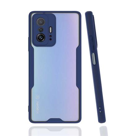 Xiaomi Mi 11T 5G Uyumlu Kılıf Zore Parfe Kapak