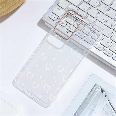 Xiaomi Redmi Note 11 Pro 5G Uyumlu Kılıf Zore Sidney Desenli Sert Kapak