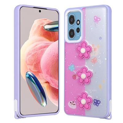 Xiaomi Redmi Note 12 4G Uyumlu Kılıf Parlayan Simli Kabartma Figürlü Zore Cevze Kapak
