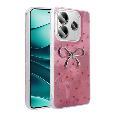Xiaomi Redmi Note 14 4G Uyumlu Kılıf Kamera Korumalı Figürlü Zore Ponti Silikon Kapak