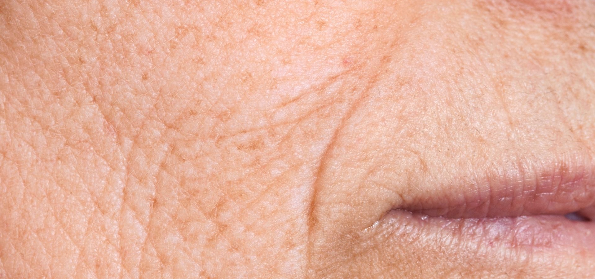 Cilt Kırışıklığına Karşı Anti-Aging Ürünler