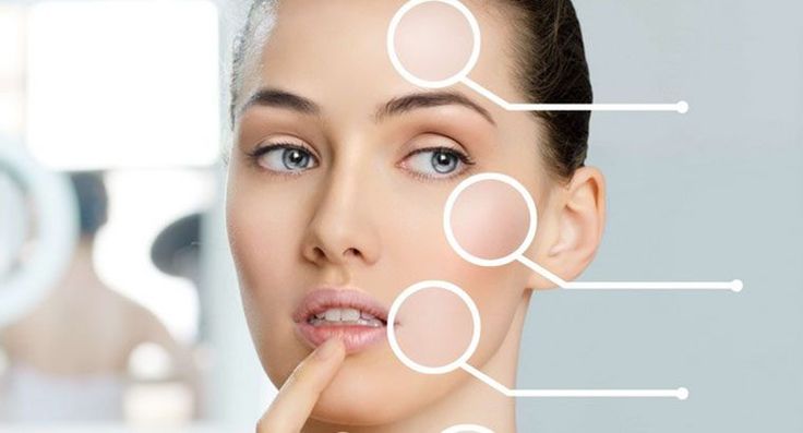 Hiperkeratoz: Kalınlaşmış Cilt İçin Bakım İpuçları