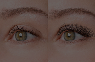 Why are eyebrows and eyelashes falling out? How can you stop the loss?