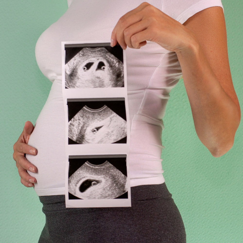 Trimester Dönemleri