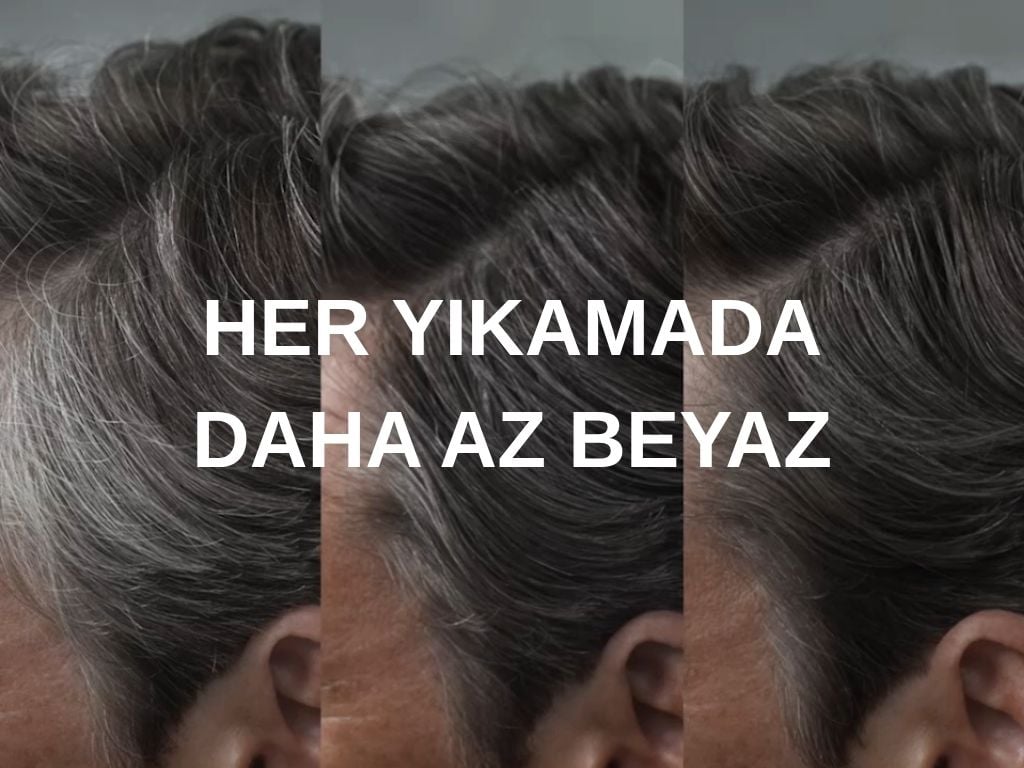 Control GX Şampuan: Beyazlarla Boyayarak Değil, Yıkayarak Vedalaşın