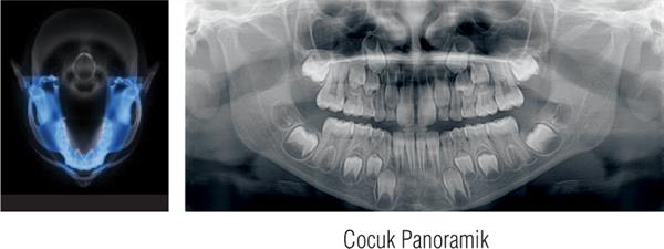 Cs 8100 2D 4. Nesil Panoramik Röntgen Sistemi