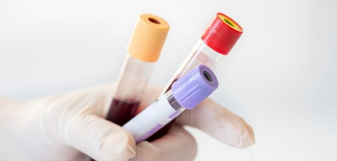 Kan Tahlili Değerleri