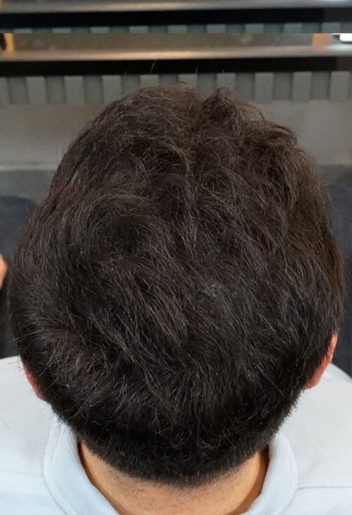 Before Image