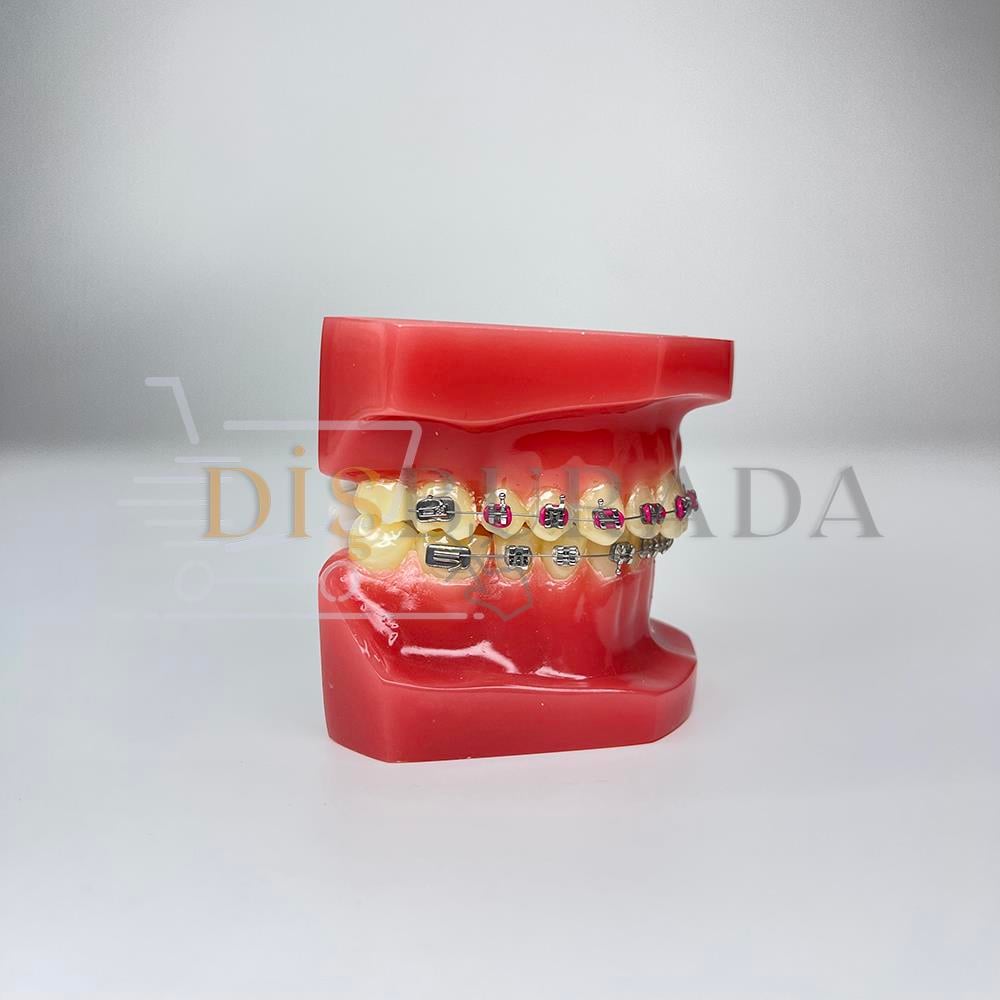 Diamonds Ortodontik Model Diş 2
