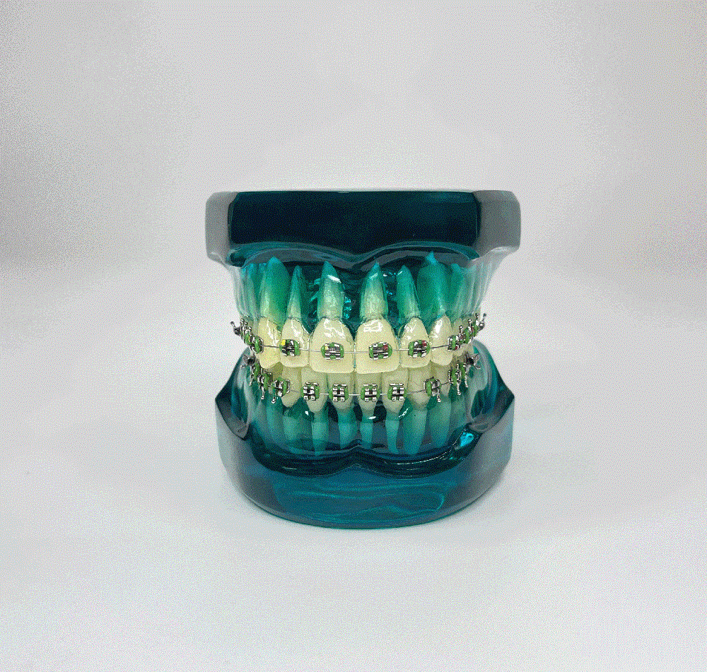 Diamonds Ortodontik Model Diş