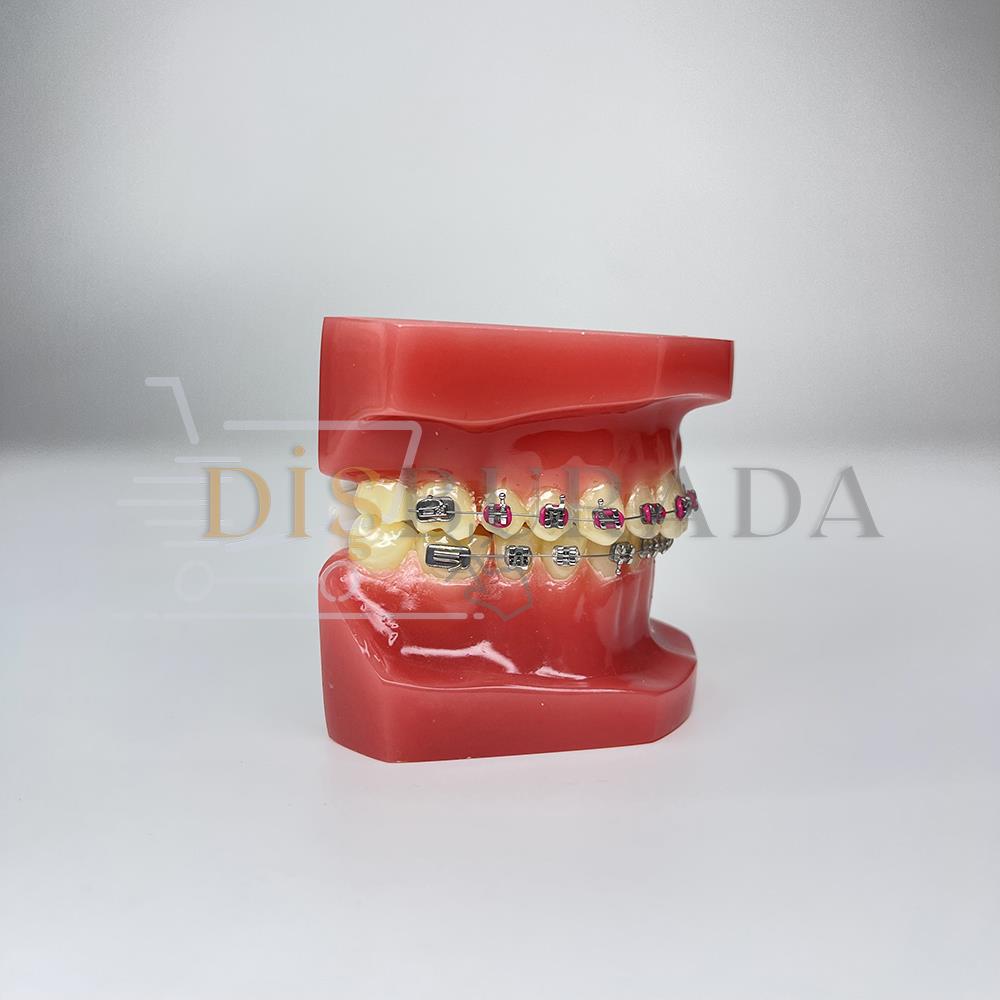 Diamonds Ortodontik Model Diş 2