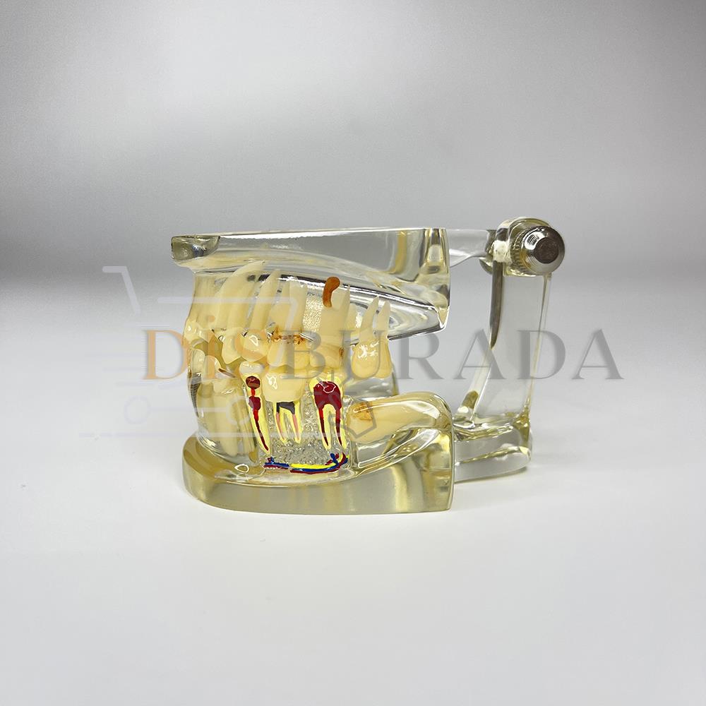 Diamonds Şeffaf İmplant Model Diş