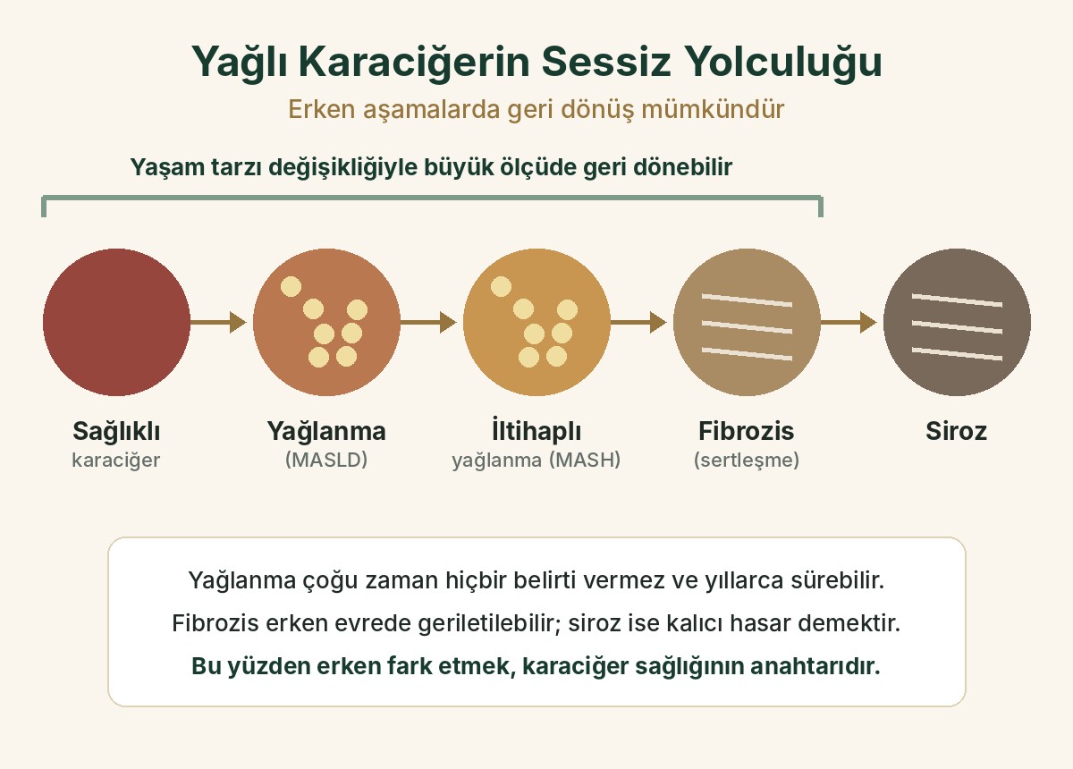 Yağlı karaciğerin aşamaları: sağlıklı karaciğer, yağlanma, iltihaplı yağlanma, fibrozis ve siroz; ilk aşamalarda geri dönüş mümkündür