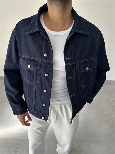 Retro Model Basic Oversize Kot Ceket