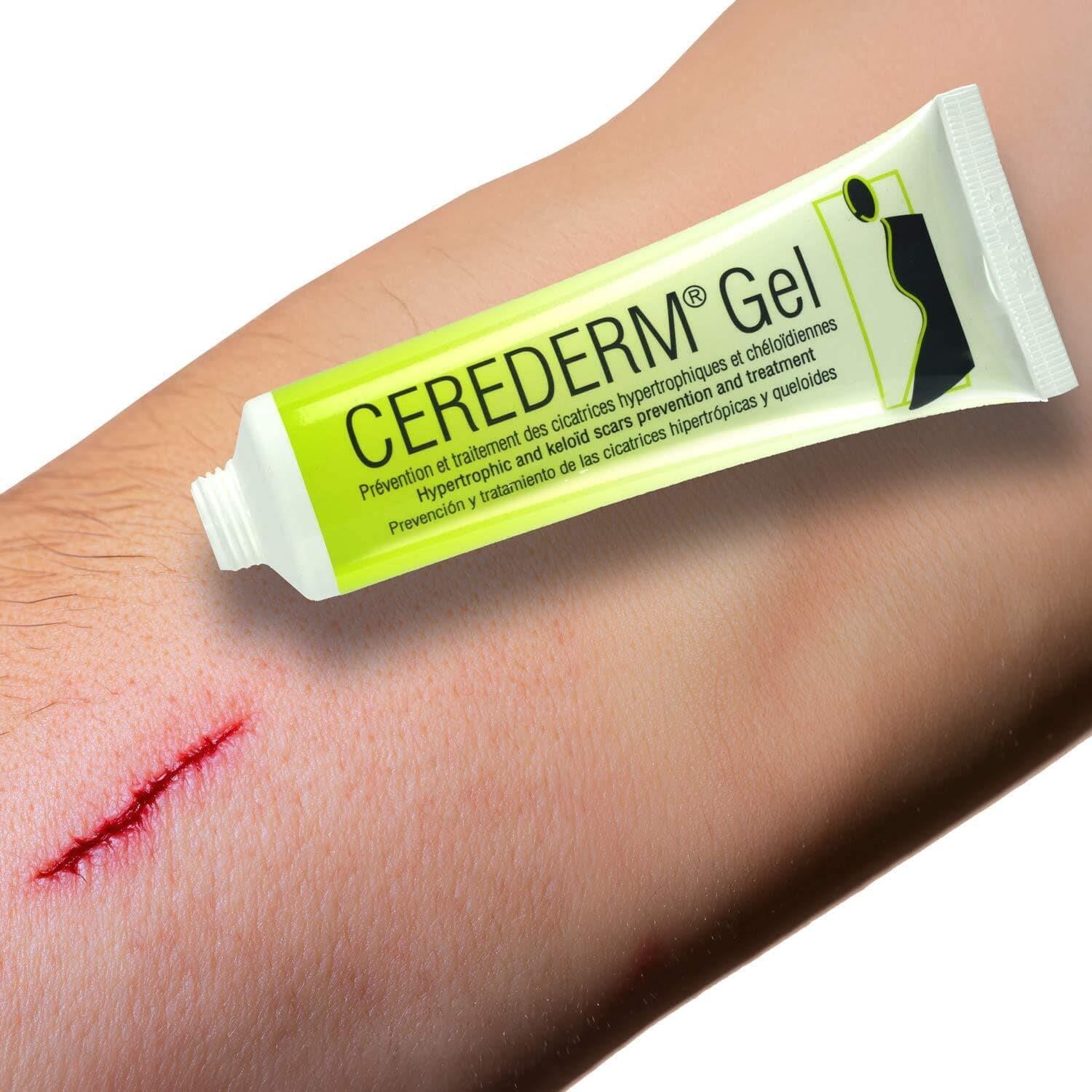 Cerederm Skar İzi Giderici