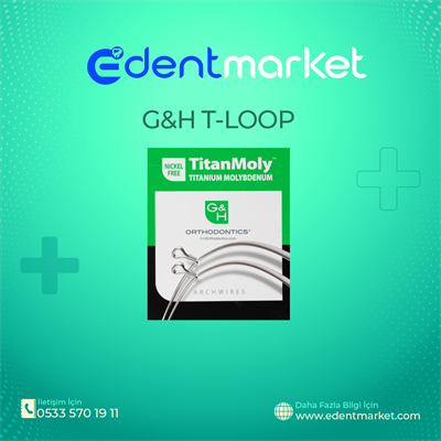 TITANMOLY T-LOOP 017x025 Tel 5/PK
