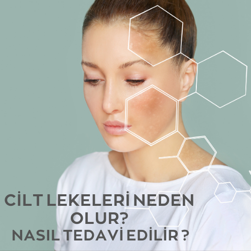 CİLT LEKELERİ NEDEN OLUR?  NASIL TEDAVİ EDİLİR ?
