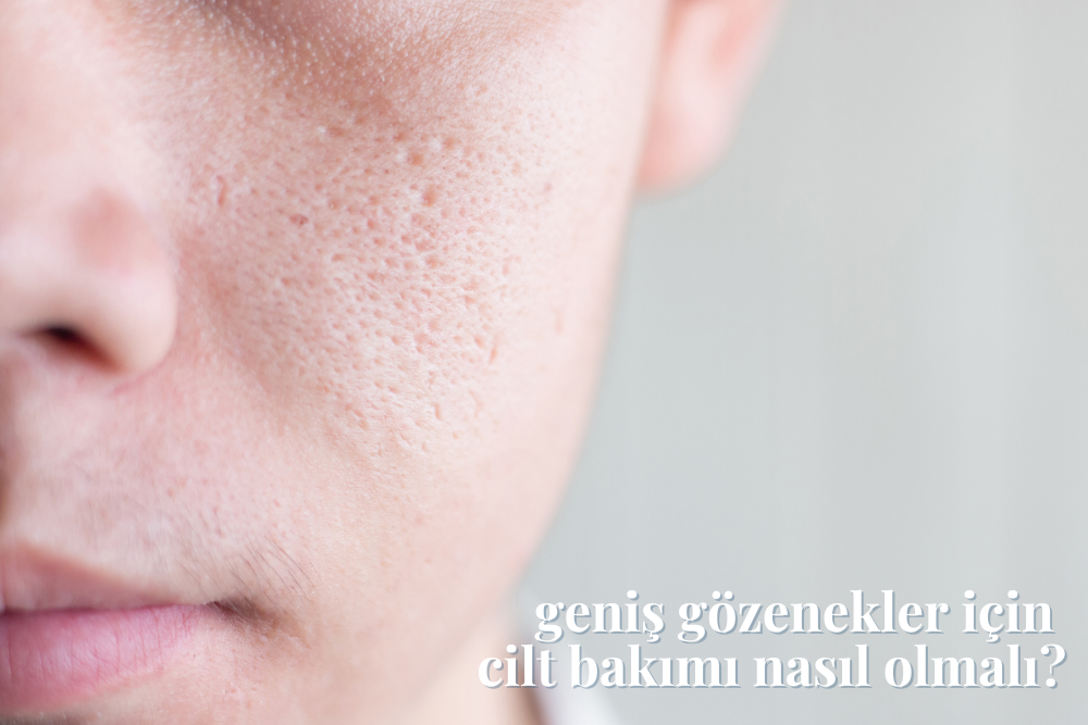 Geniş Gözenekleri Sıkılaştırma Yolları | Magic Company & Co