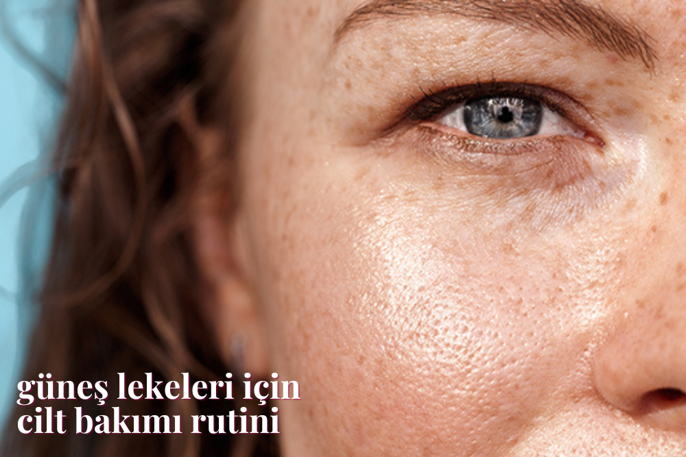 Güneş Lekeleri Nasıl Geçer? | Magic Company & Co