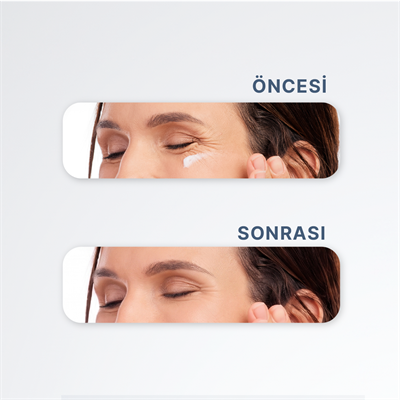 Yoğun Nemlendirici, Kırışıklık ve Koyu Halka Karşıtı Peptit İçeren Göz Çevresi Kremi - 30 ml