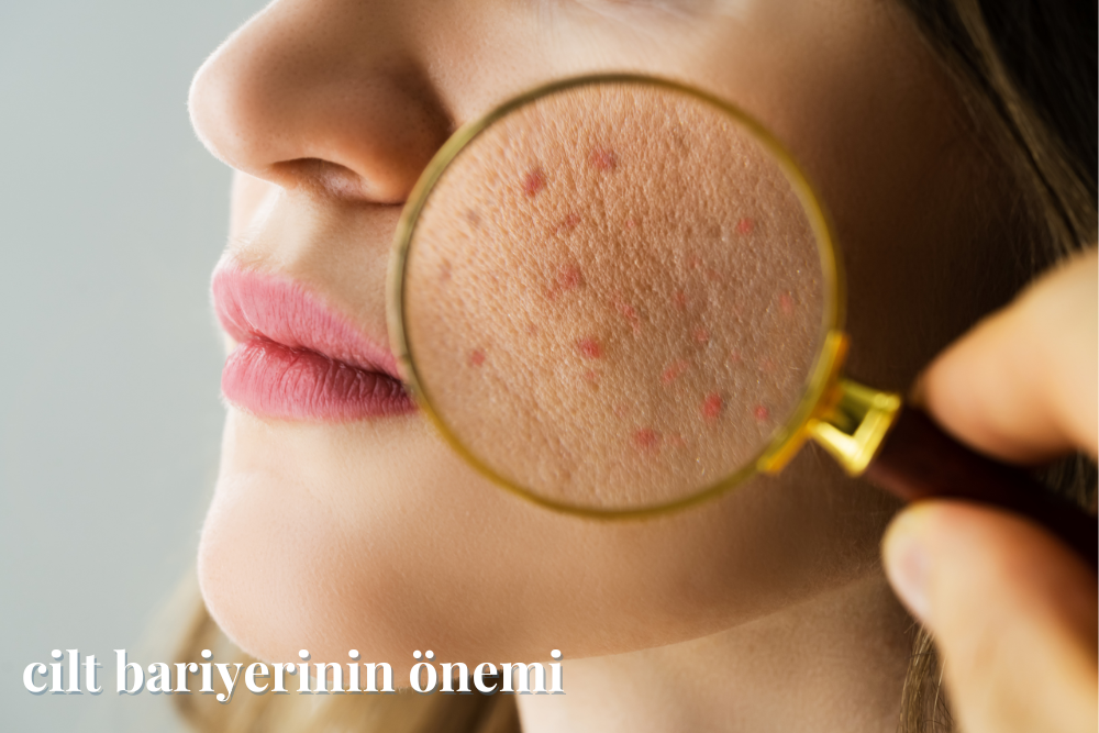 Cilt Bariyeri Nedir? Cilt Bariyeri Nasıl Onarılır? | Magic Company & Co