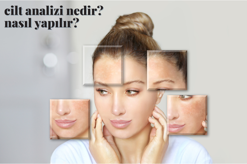 Cilt analizi