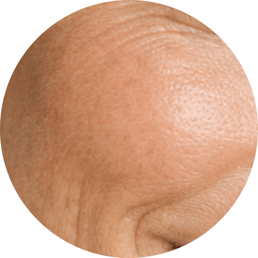 Yaşlanma & Kırışıklık