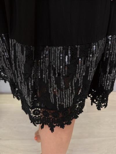 1350 Italyan Dantel Detay Elbise Siyah