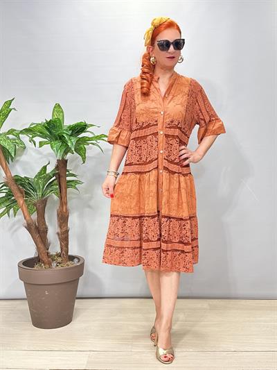 2090 Fisto Dantel Detaylı Elbise Tarçın