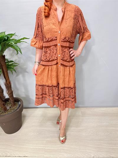 2090 Fisto Dantel Detaylı Elbise Tarçın