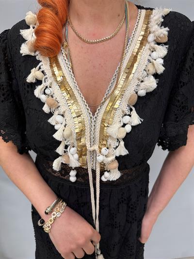 2870 Dantel Detay Elbise Siyah