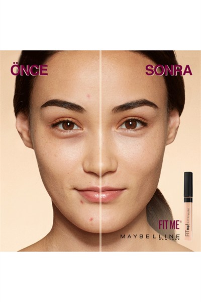 Maybelline New York Fit Me Kapatıcı 20 Sand