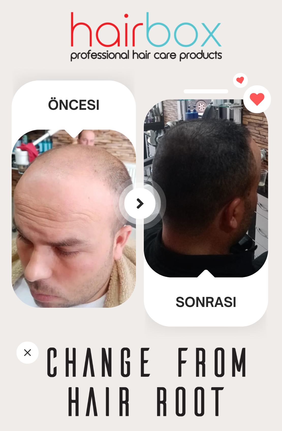 Hairbox Erkek Saç Serumu (Serum + Şampuan + Roller)