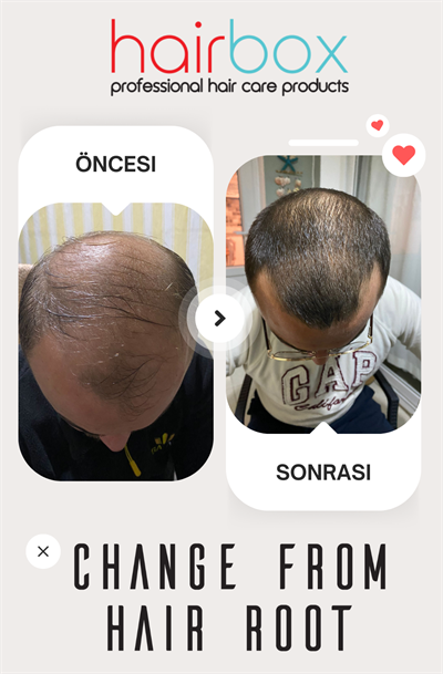 Hairbox Erkek Saç Serumu (3 Adet Serum)
