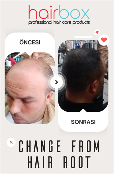 Hairbox Erkek Saç Serumu (Serum + Şampuan + Roller)