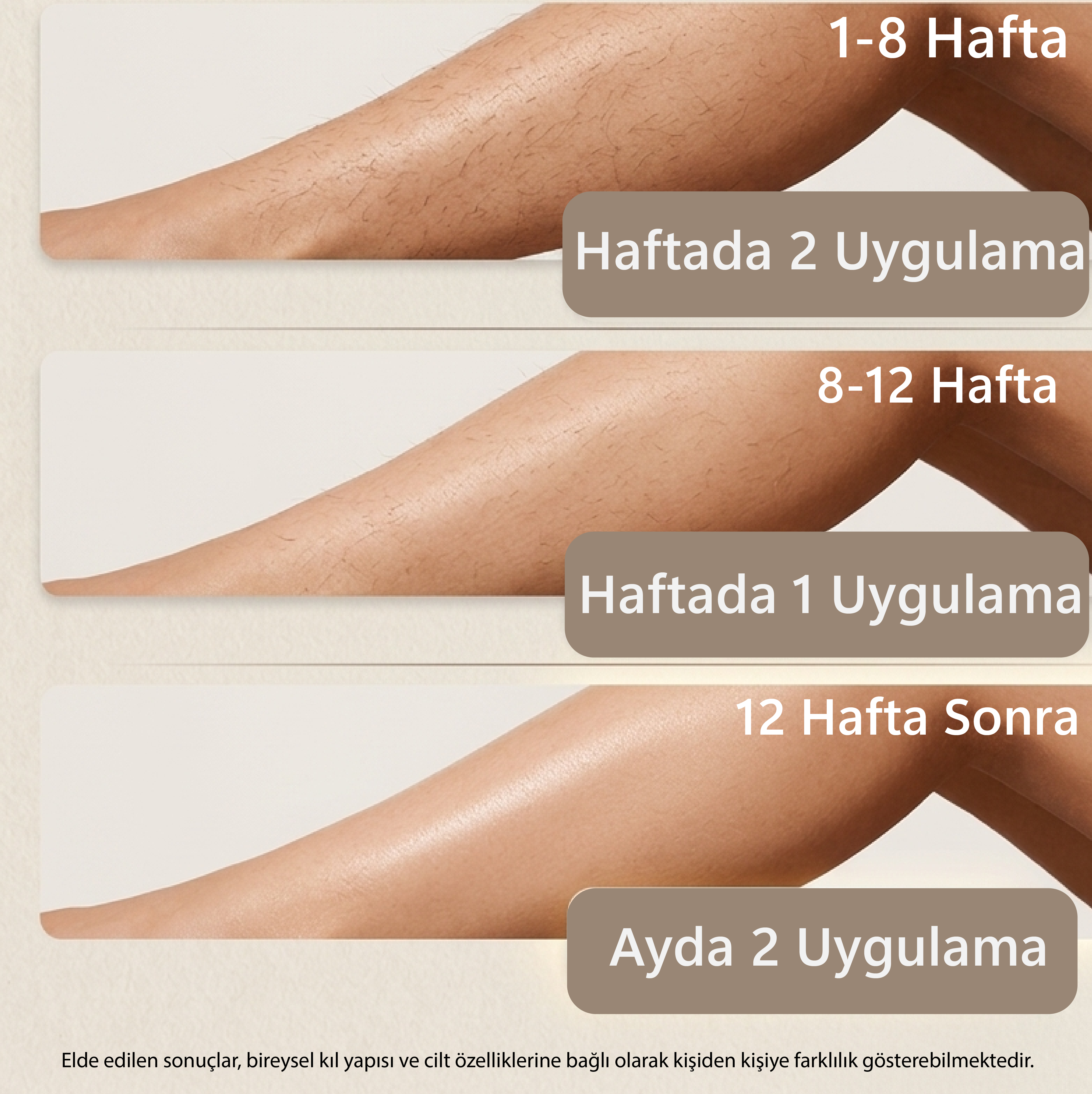 Robx A2030 IPL Sapphire Sogutma 35 joule Ultra Güç Hızlı Etki Çoklu Seri Otomatik Atım Bay Bayan
