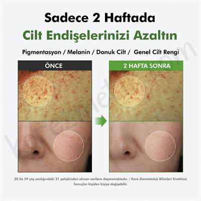 Dr. Althea %20 Gentle Vitamin C Serum - Leke Ve Akne Karşıtı - 30ml 