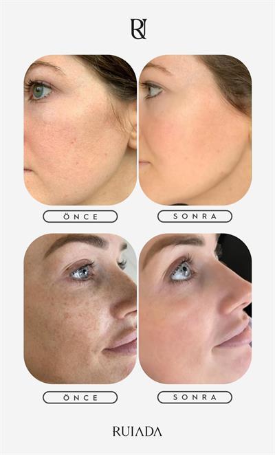 Flowers Series +50 Factor Yüz Kesesi %100 Floş İpek (PINK)