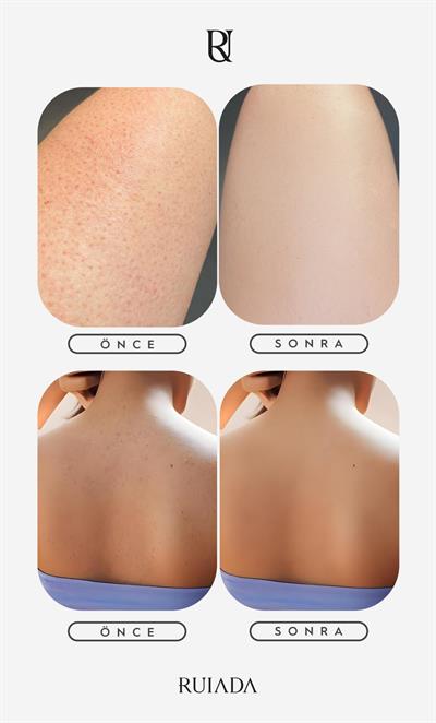 Flowers Series 50 Factor %100 Floş Ipek Ince Banyo Duş Kesesi Peeling Eldiveni (BLUE)