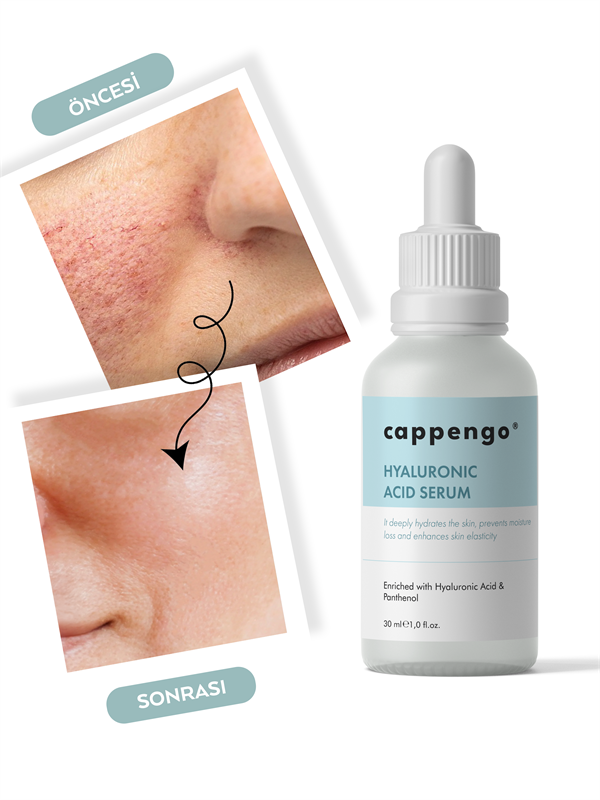 CAPPENGO HYALURONIC ACID SERUM 30 ML