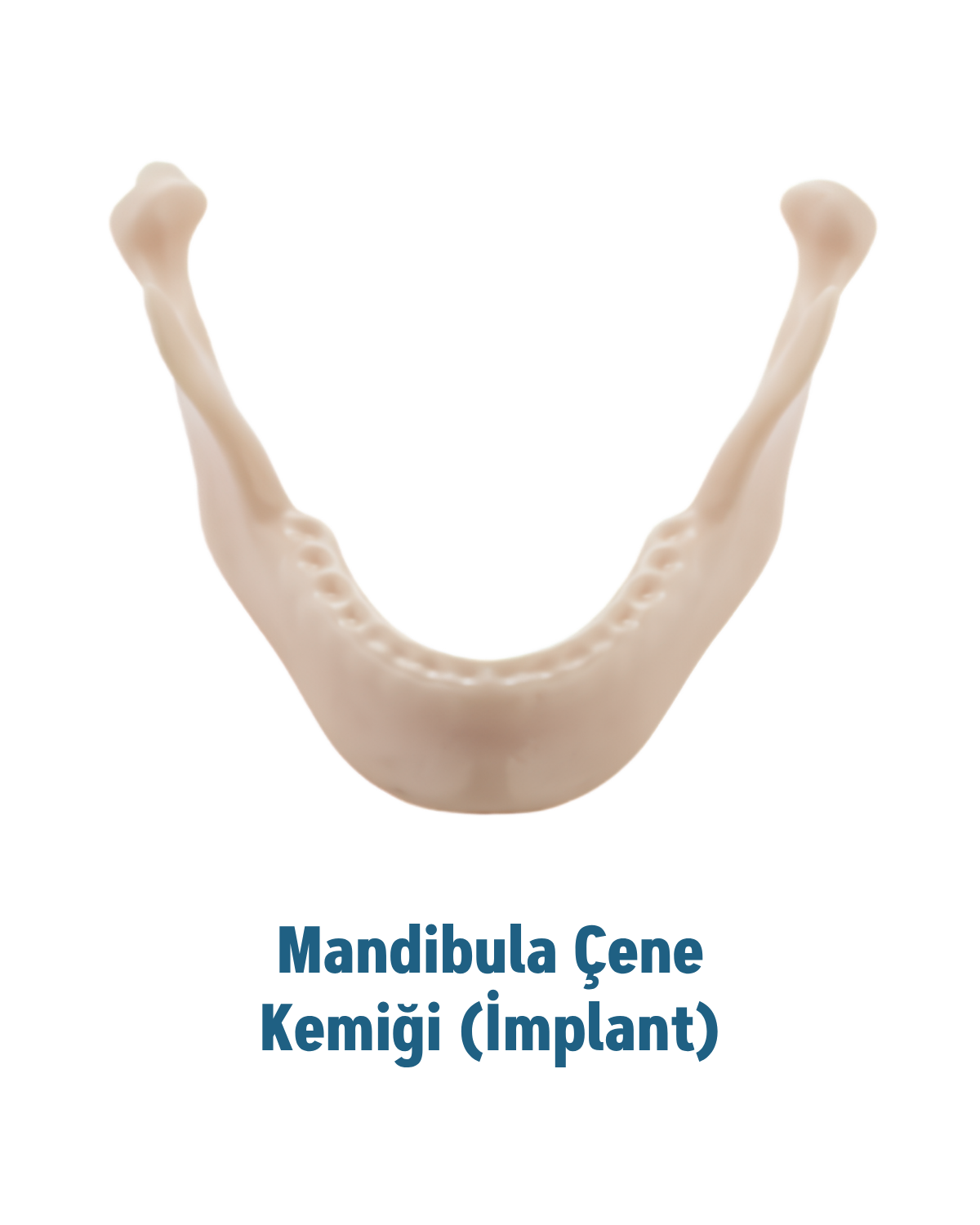 Mandibula Çene Kemiği (İmplant)MALL OF DENTMandibula Çene Kemiği (İmplant) - DENTAL CEPTE