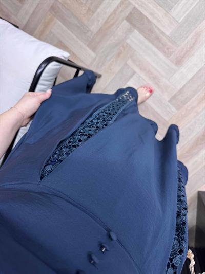 Eteği Dantel Volanlı Karpuz Kol Tasarım Elbise Mavi